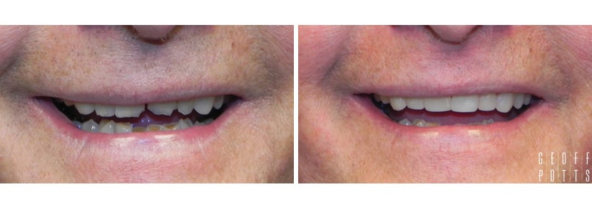 Patient before and After photo 1