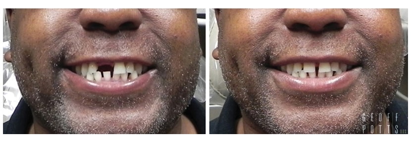 Patient before and After photo 8